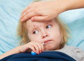 В лютому на кір захворіло менше львів’ян, ніж у січні